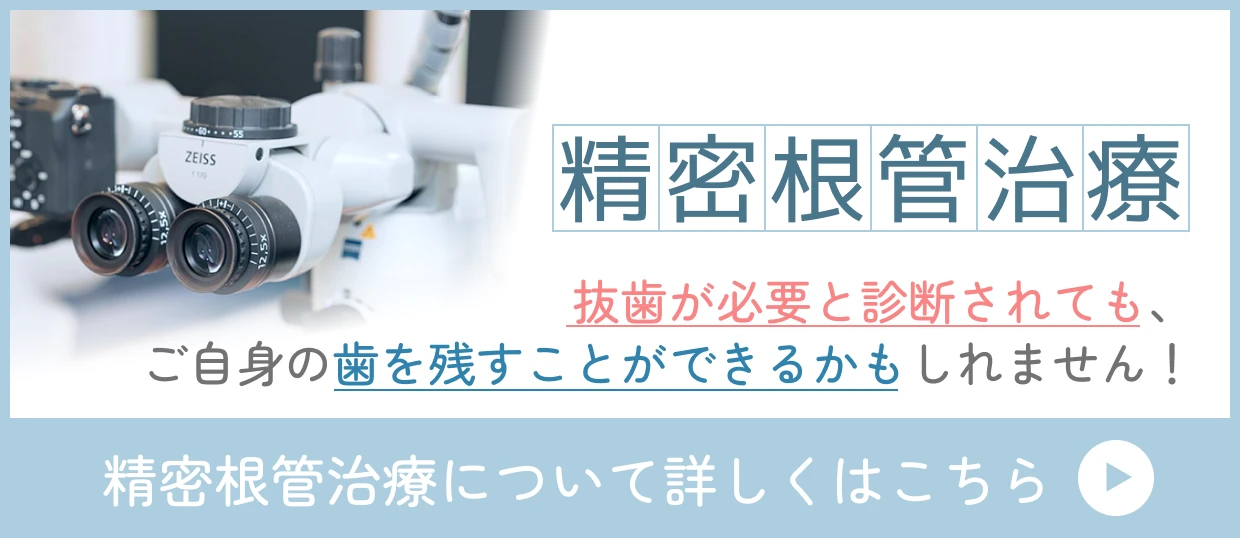 根管治療についてはこちら